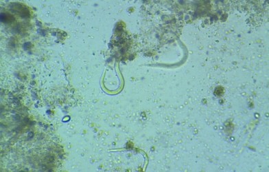Strongyloidiasis (Zoonotic) S. stercoralis